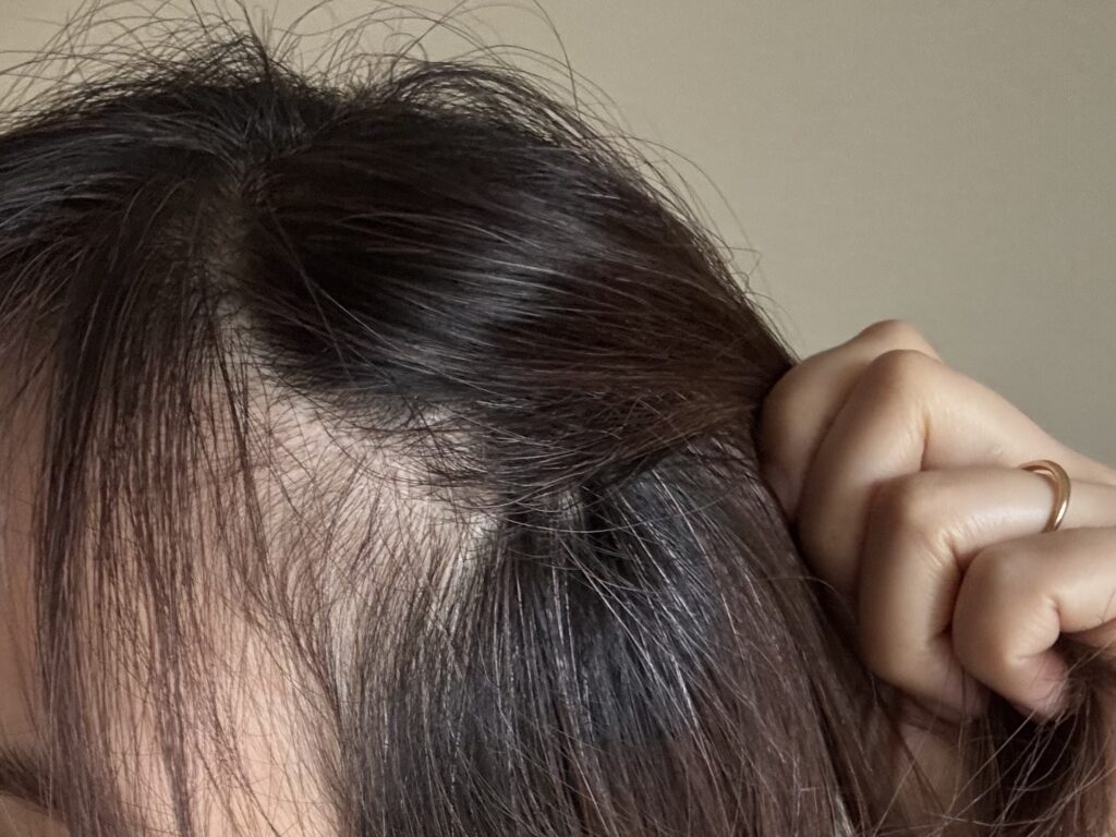 サイオスのカラートリートメントを使用してから３日目