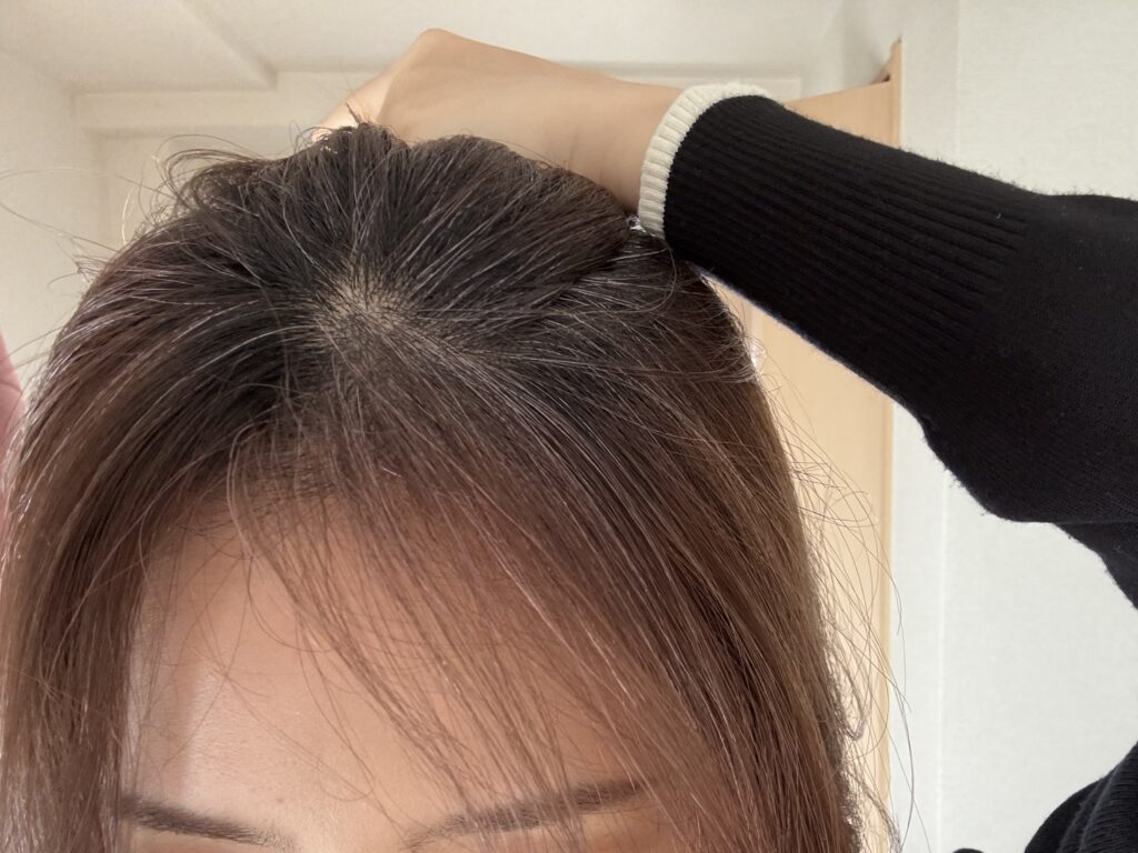 30代 グレイヘア移行1ヶ月目