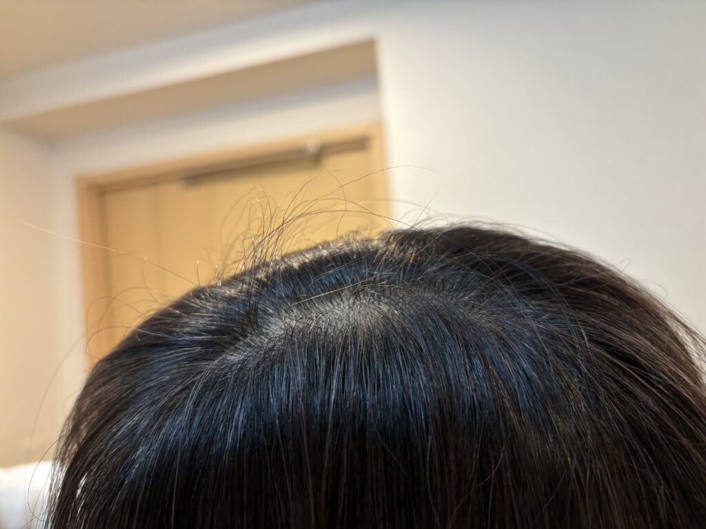 サイオスのカラートリートメントを1回使用した様子