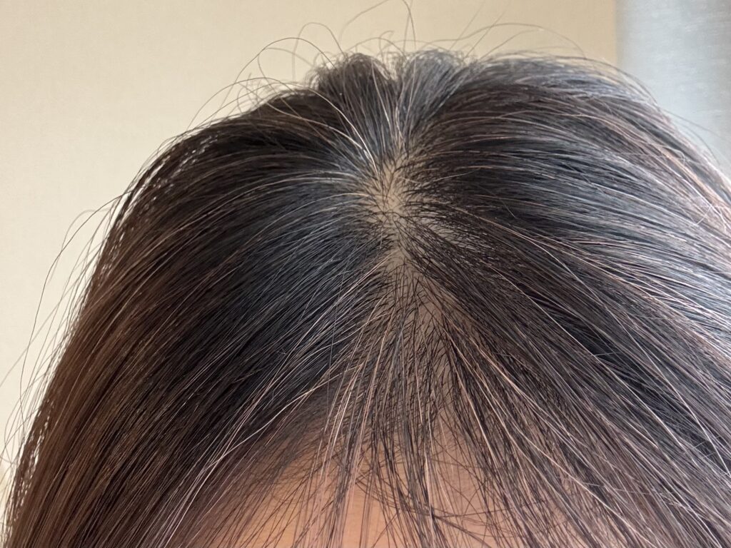 サイオスのカラートリートメントを使用してから３日目