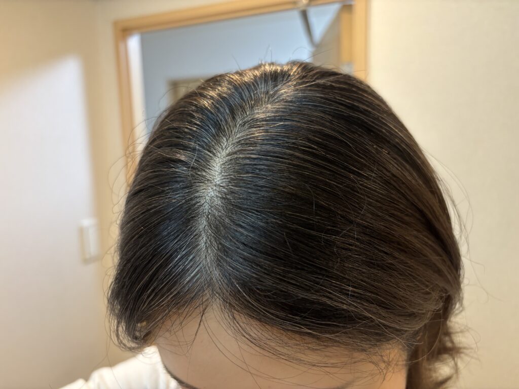 30代 グレイヘア移行4ヶ月目