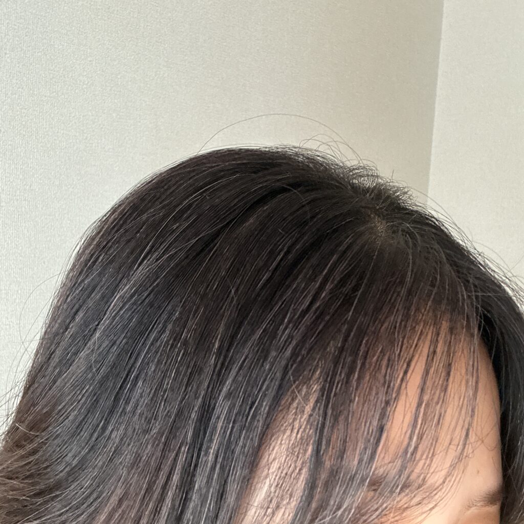 30代グレイヘア移行中の写真