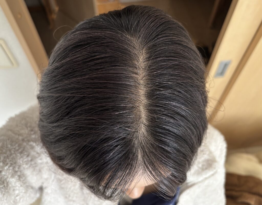 グレイヘア移行中にアンナドンナ　カラートリートメント（アッシュベージュ）を使用後の髪の様子