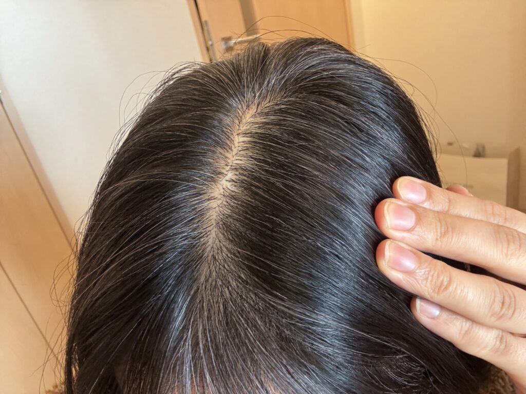 30代女性グレイヘア移行中