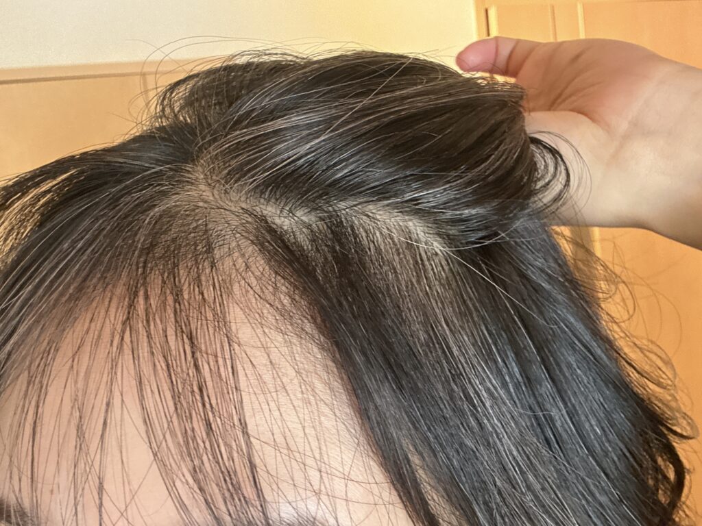 30代女性グレイヘア移行中