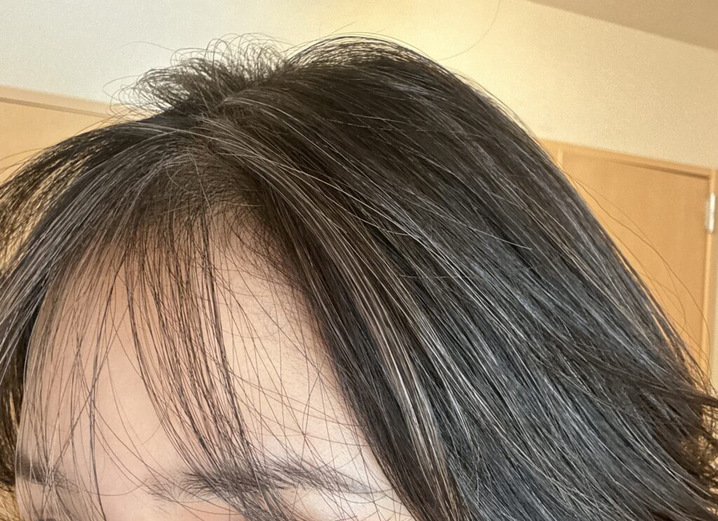 30代女性グレイヘア移行中
