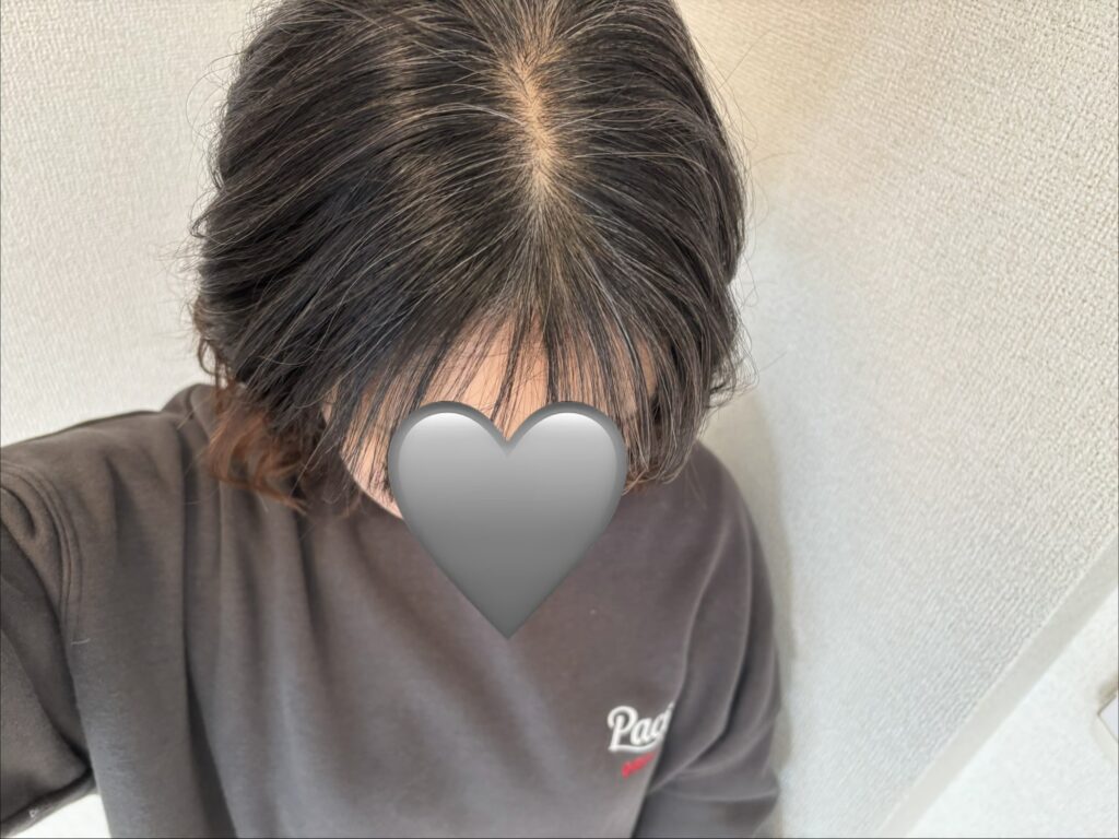 30代女性グレイヘア移行中