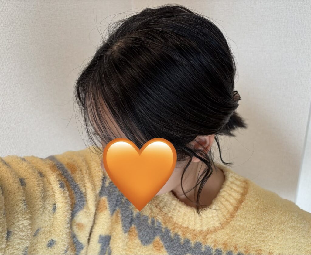 30代女性グレイヘア移行中
