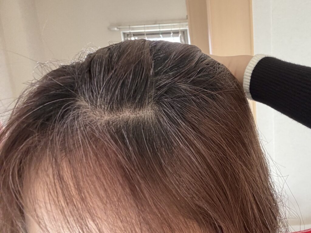 白髪染めをやめて1ヶ月目の様子