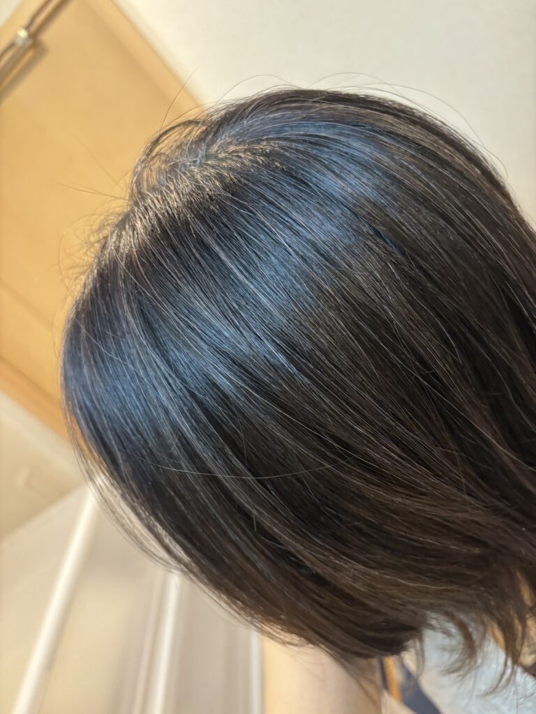 30代グレイヘア移行中の様子