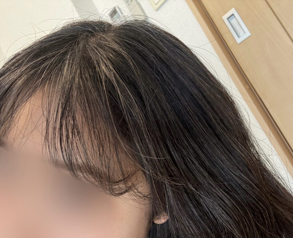 白髪にクオルシア ベージュシャンプー・ブラウンシャンプーを使った様子