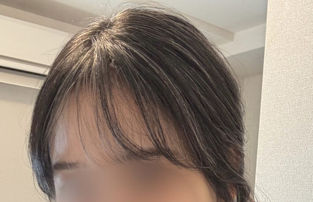 30代グレイヘア移行13ヶ月目
