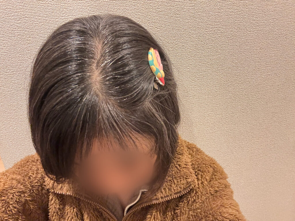 30代グレイヘア移行13ヶ月目