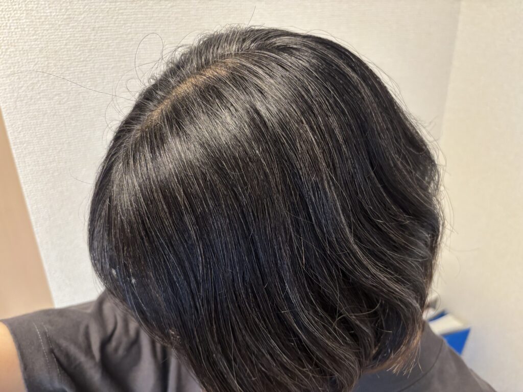 30代グレイヘア移行中