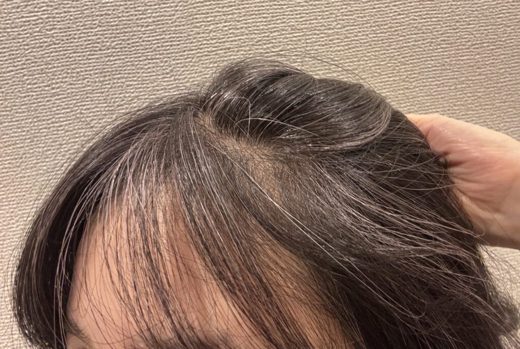 30代グレイヘア移行中
エブリアンナドンナのカシスピンクトリートメント使用後