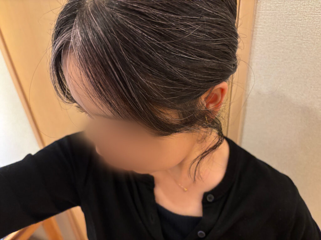 30代　グレイヘア移行中