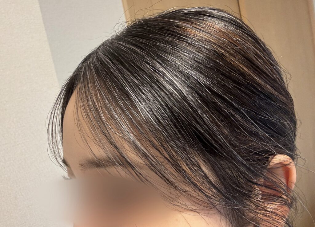 30代グレイヘア移行中
ハイライトあり