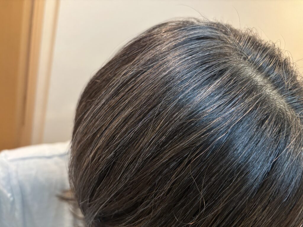30代のグレイヘア移行記録
クレイスパモカブラウン使用数日後